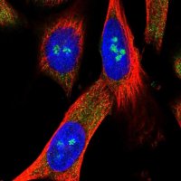 Anti-METTL5 antibody produced in rabbit 