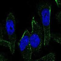Anti-MEX3C antibody produced in rabbit