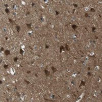 Anti-MFAP3 antibody produced in rabbit HPA015883-100UL