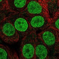 Anti-MFSD10 antibody produced in rabbit 