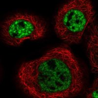 Anti-MFSD11 antibody produced in rabbit HPA022001-100UL