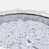 Anti-MFSD13A antibody produced in rabbit HPA018031-100UL