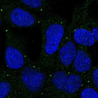 Anti-MFSD3 antibody produced in rabbit 