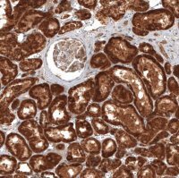 Anti-MICU1 antibody produced in rabbit 