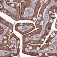 Anti-MICU2 antibody produced in rabbit