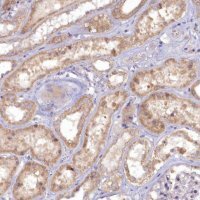 Anti-MICU2 antibody produced in rabbit