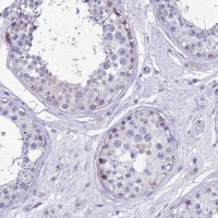 Anti-MIIP antibody produced in rabbit 
