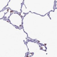Anti-MIIP antibody produced in rabbit 