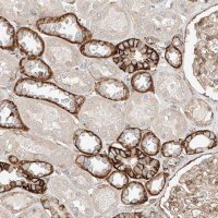 Anti-MINDY4 antibody produced in rabbit 