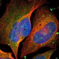 Anti-MIS18BP1 antibody produced in rabbit 