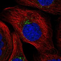 Anti-MITD1 antibody produced in rabbit