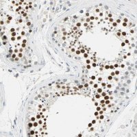 Anti-MLLT10 antibody produced in rabbit 