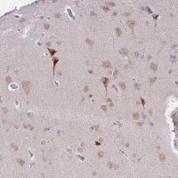Anti-MLLT11 antibody produced in rabbit 