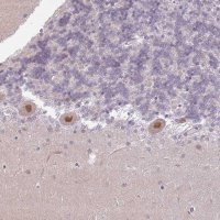 Anti-MLLT11 antibody produced in rabbit 
