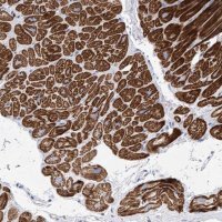 Anti-MLYCD antibody produced in rabbit HPA031625-100UL