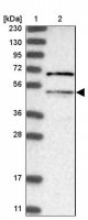 Anti-MLYCD antibody produced in rabbit HPA031625-100UL