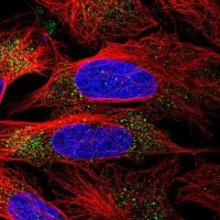 Anti-MMAA antibody produced in rabbit 