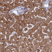 Anti-MMAB antibody produced in rabbit