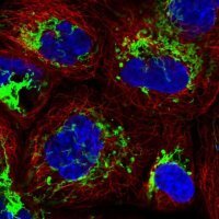 Anti-MMAB antibody produced in rabbit