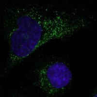 Anti-MMP1 antibody produced in rabbit 
