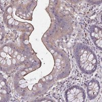 Anti-MMP14 antibody produced in rabbit 