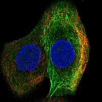 Anti-MMP14 antibody produced in rabbit 