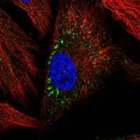 Anti-MMP19 antibody produced in rabbit 