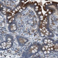 Anti-MOGAT3 antibody produced in rabbit