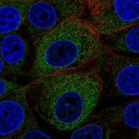 Anti-MOGS antibody produced in rabbit HPA011322-100UL