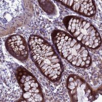 Anti-MON1B antibody produced in rabbit HPA046285-100UL