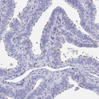 Anti-MORN2 antibody produced in rabbit 