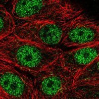 Anti-MORN2 antibody produced in rabbit 