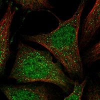 Anti-MOSPD1 antibody produced in rabbit 