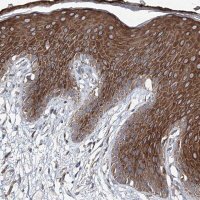 Anti-MPHOSPH9 antibody produced in rabbit 