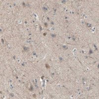Anti-MPI antibody produced in rabbit 