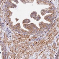 Anti-MRAS antibody produced in rabbit 