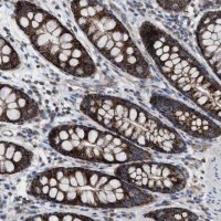 Anti-MRM1 antibody produced in rabbit 