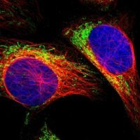 Anti-MRM1 antibody produced in rabbit 