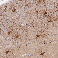 Anti-MROH1 antibody produced in rabbit 