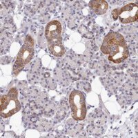 Anti-MRPL21 antibody produced in rabbit 