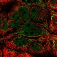 Anti-MRPL21 antibody produced in rabbit 