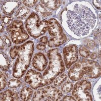 Anti-MRPL22 antibody produced in rabbit 