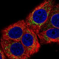 Anti-MRPL22 antibody produced in rabbit 