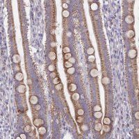 Anti-MRPS2 antibody produced in rabbit HPA057261-100UL