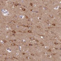 Anti-MRPS25 antibody produced in rabbit HPA043490-100UL