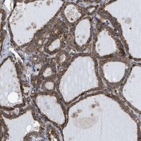 Anti-MRPS30 antibody produced in rabbit HPA021149-100UL