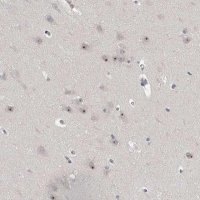 Anti-MRTO4 antibody produced in rabbit 