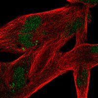 Anti-MSANTD4 antibody produced in rabbit