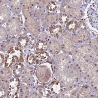 Anti-MT-CO3 antibody produced in rabbit 