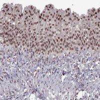 Anti-MT1E antibody produced in rabbit 